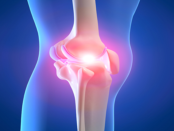 коленный сустав в разрезе