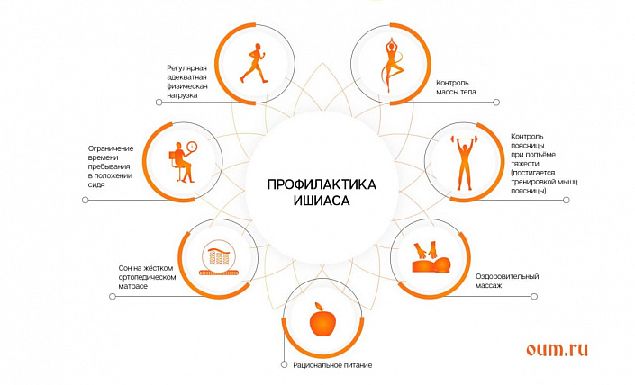 профилактика ишиаса