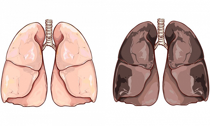 рисунок, легкие, курильщик