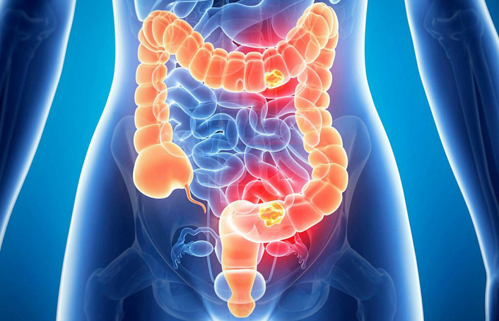 кишечник человека