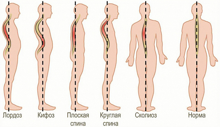 варианты позвоночника