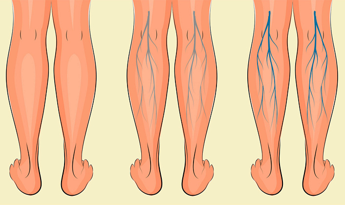 ноги, вены