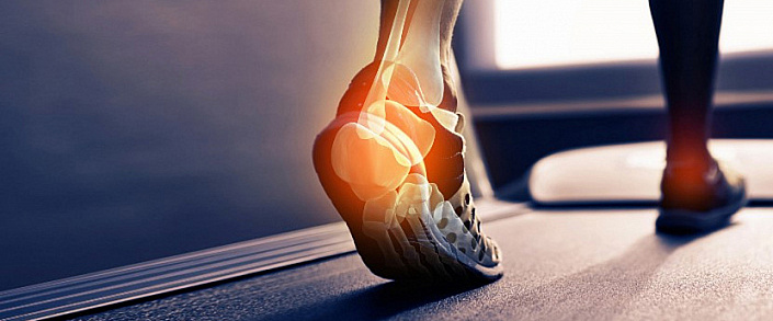 стопа при ходьбе в разрезе